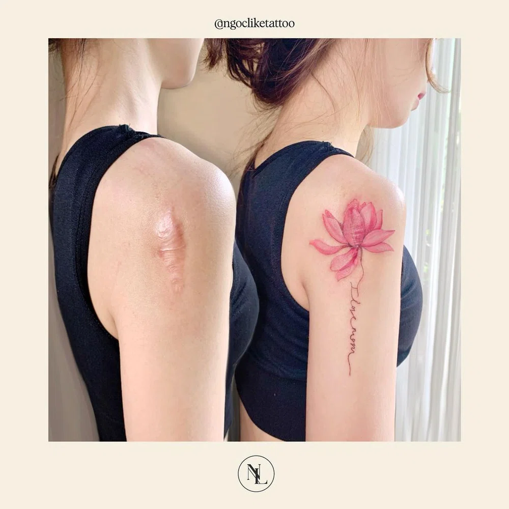 Can You Get a Tattoo Over a Scar  AuthorityTattoo