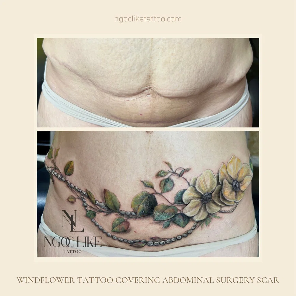 Mothers CoverUp CSection Scars with Tattoos New Beauty Trend  News18