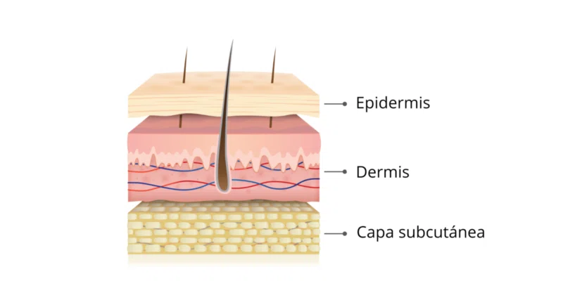 esquema gráfico de las capas de la piel humana. Epidermis, dermis y subcutánea