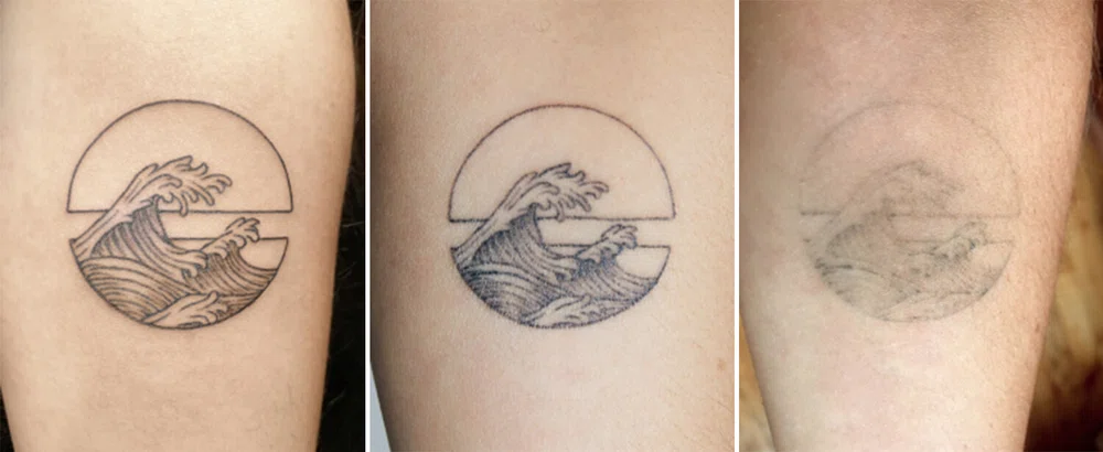 What My MadetoFade Ephemeral Tattoo Looks Like Two Years Later  See  Photos  Allure