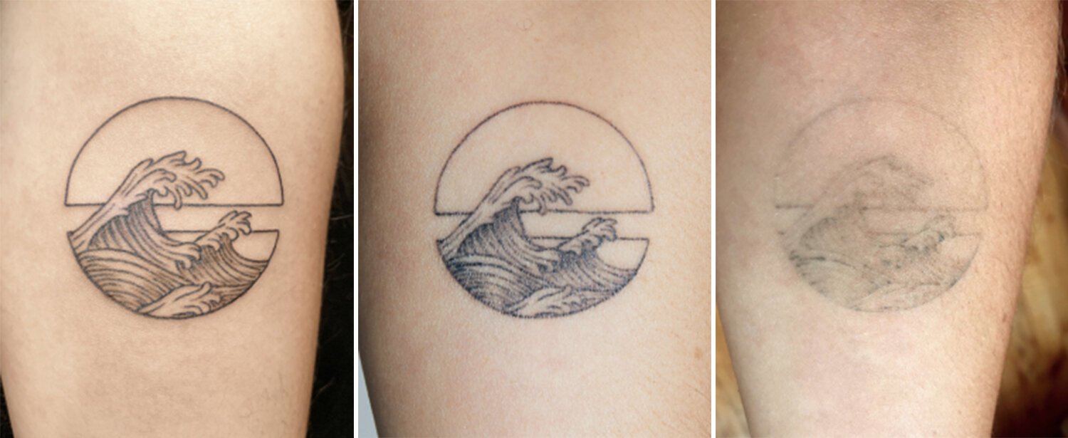 Temporary Tattoos Are Trendy, Low-Cost Ink Alternative | Money