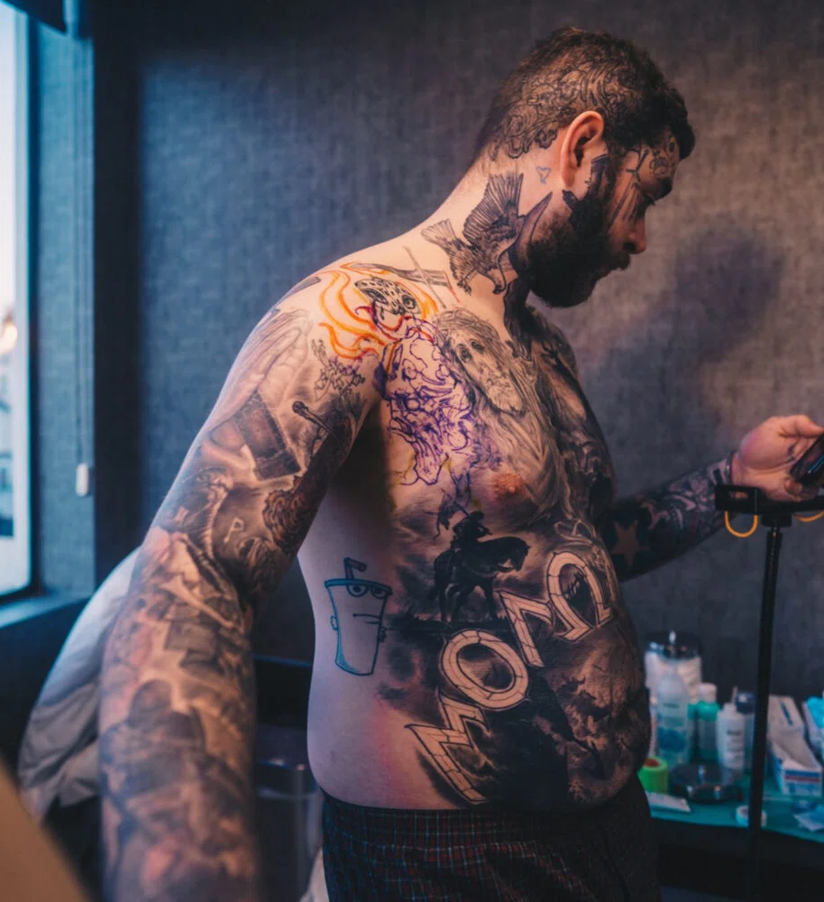 Tattooing with anesthesia
