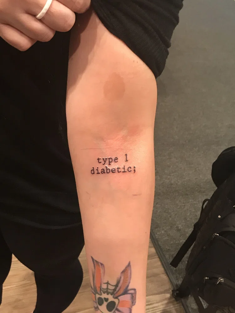 Can I Get A Tattoo If I Have Diabetes?